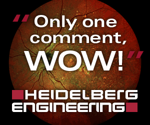 Sam Miller designs for Heidelberg Engineering